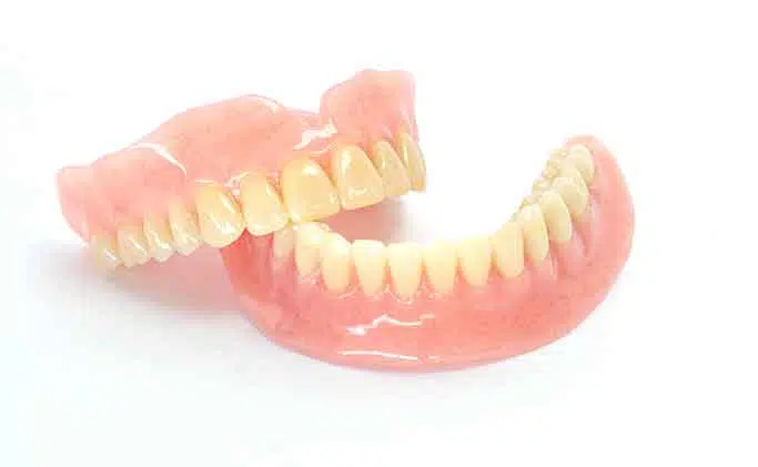 complex implant retained denture